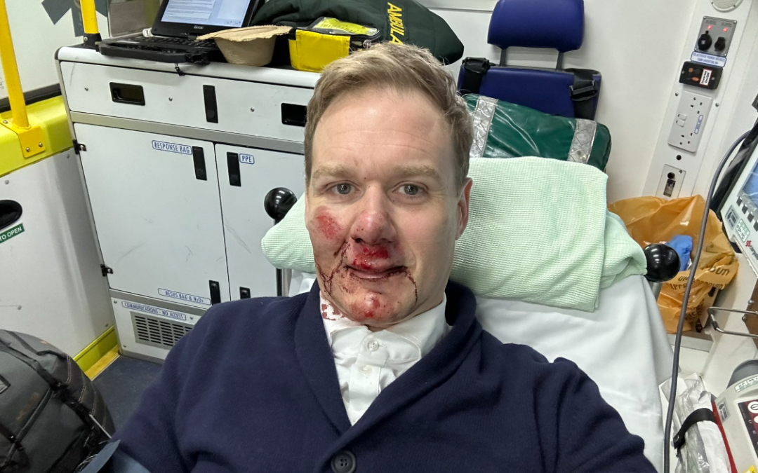 Dan Walker “battered and bruised” but alive after being hit by car