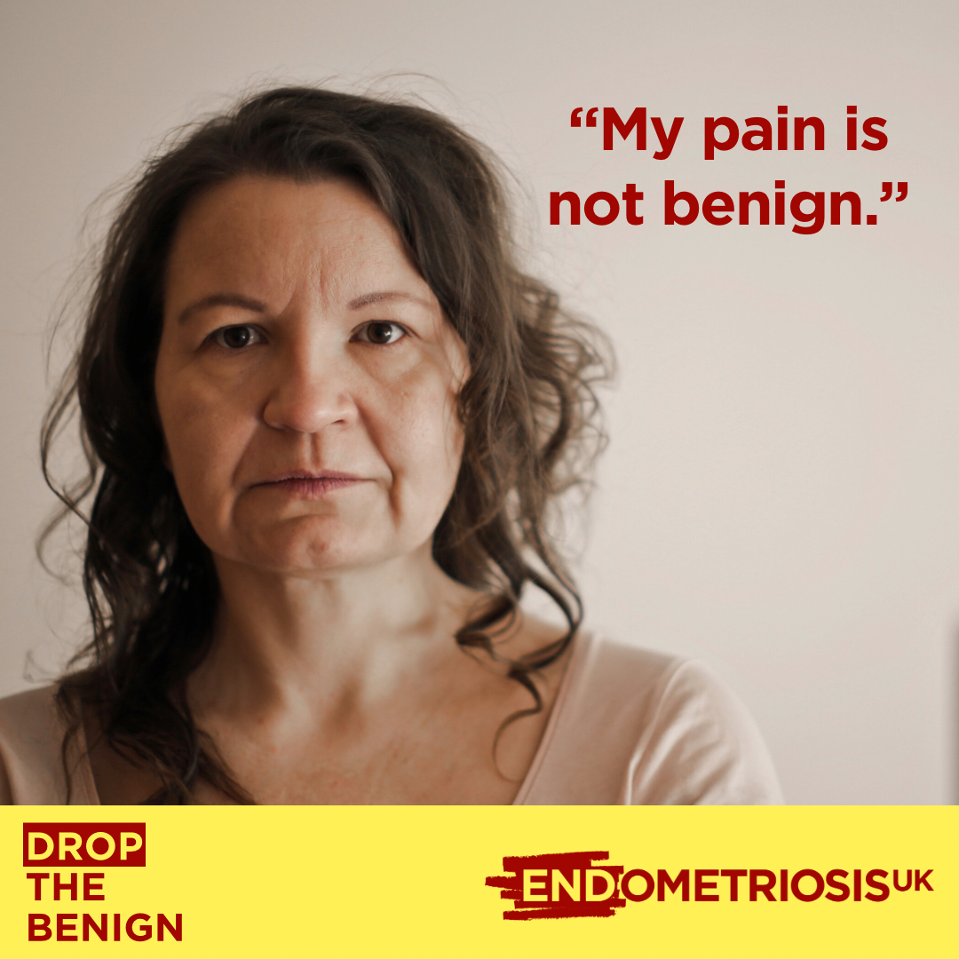 Endometriosis: Changes needed around thoughtless language