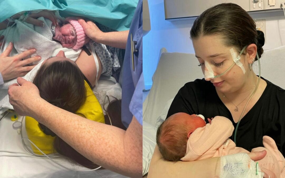 Mum thought she would die in ‘horror movie’ birth