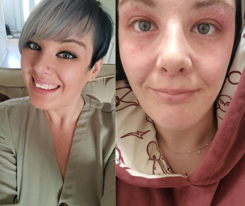 New flu strain “completely knocked me off my feet,” says Woodhouse woman