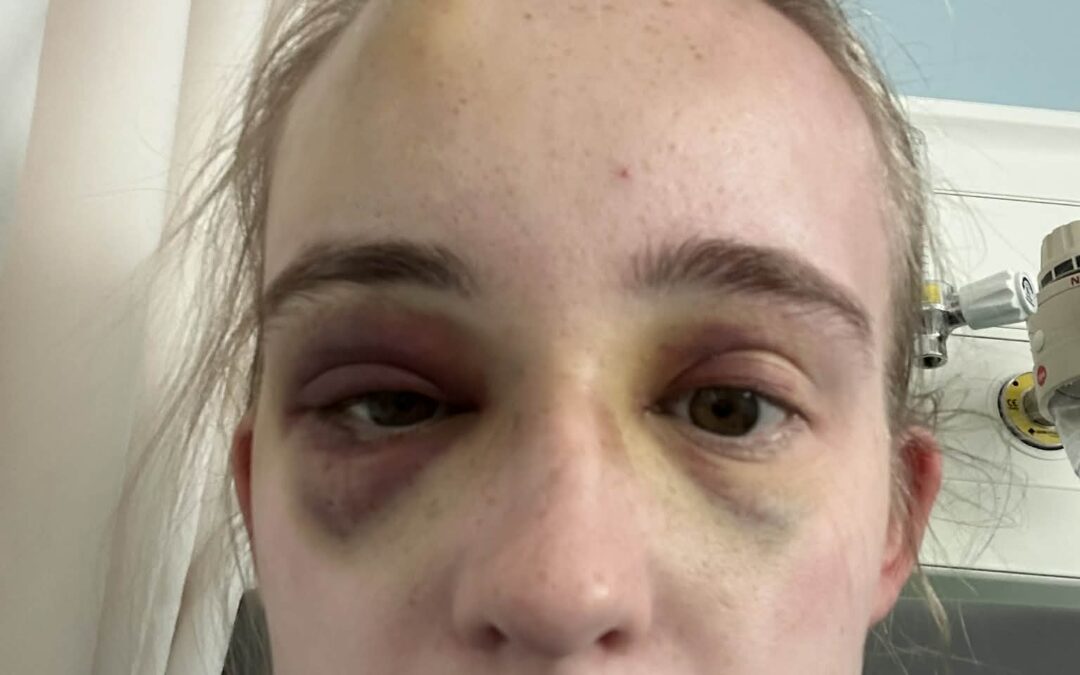 Sheffield woman calls for greater epilepsy awareness following public seizure