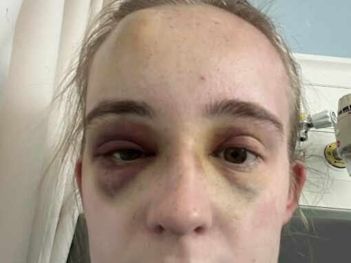 Sheffield woman calls for greater epilepsy awareness following public seizure